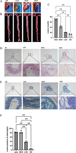 Figure 9 Aortic atherosclerosis in different groups of diabetic ApoE−/− mice after 6 months of intervention with different content of carbohydrate diet. KD group: ketogenic diet group (n=3); LCD group: low-carbohydrate diet group (n=3); MCD group: medium-carbohydrate diet group (n=3); HCD group: high-carbohydrate diet group (n=3) (A) Macroscopic view of aorta of diabetic ApoE−/−mice treated with four different carbohydrate diets; (B) Oil red in aorta of diabetic ApoE−/− mice fed with four different carbohydrate diets; (C) Oil red plaque area of aorta in four groups of diabetic ApoE−/− mice with different carbohydrate content diet intervention; (D) HE staining of local aorta of diabetic ApoE−/− mice treated with four different carbohydrate diets (scale bar: first row 200 μm; Second row: 20 μm); (E) Masson staining of local aorta of diabetic ApoE−/− mice treated with four different carbohydrate diets (scale bar: first row 200 μm; Second row: 20 μm); (F) lumen area of aortic plaque in diabetic ApoE−/− mice treated with four different carbohydrate diets; **represents P<0.01.