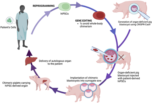 Figure 4 Schematic representation of proposed workflow for generation of personalized chimeric livers as a treatment for ESLD through isolation and subsequent utilization of patient-derived hiPSCs for interspecies blastocyst complementation.