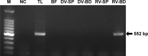 Figure 4 Detection of viral RNA of rotavirus adsorbed onto antibody-integrated MNBs.Notes: Rotavirus-infected cell lysate (10 µL) was diluted with PBS (500 µL) and then incubated with antibody-integrated magnetic beads. After incubation, the following fractions were obtained: 1) diluted rotavirus sample before incubation with the beads (BF), 2) bead fraction after incubation with anti-rotavirus antibody-integrated MNBs (RV-BD), 3) bead fraction after incubation with anti-dengue virus antibody-integrated MNBs (DV-BD), 4) supernatant fraction after incubation with the anti-rotavirus antibody-integrated MNBs (RV-SP), 5) supernatant fraction after incubation with the anti-dengue virus antibody-integrated MNBs (DV-SP), and 6) total sample containing the same quantity of rotavirus as in 10 µL of rotavirus-infected cell lysate (total fraction, TL). Viral genomic RNA was subsequently extracted from the above fractions using a QIAamp Viral RNA mini kit and subjected to a RT-reaction. Rotavirus viral protein 7 (VP7) gene (552 bp) in the cDNA was amplified by PCR as described in Materials and methods. PCR products were analyzed by agarose gel electrophoresis (1.2% gel). The identity of the amplified products was confirmed by DNA sequencing. The left-hand lane is size marker (M), which includes DNA of 100, 200, 300, 400, 500, 600, 700, 800, 900, 1,000, 1,200, and 1,500 bp. The position of the 552 bp band for VP7 is indicated by an arrow. The NC comprised a water sample (no rotavirus) that was subjected to RT-PCR.Abbreviations: MNBs, magnetic nanobeads; NC, negative control; RT, reverse transcription.