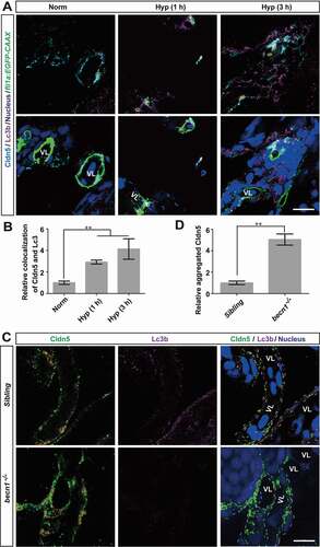 Figure 6. Autophagy suppresses the redistribution of membranous Cldn5 in zebrafish cerebrovascular endothelial cells. (A and B) Colocalization of Lc3b and Cldn5 (yellow circles) was observed in the cytosol of zebrafish BMECs after N2-induced hypoxia for 1 or 3 h respectively. Endothelial eGFP-specific transgenic Tg(fli1a:EGFP-CAAX) zebrafish (5 dpf) were used. The integrated optical density (IOD) of colocalized Lc3b and Cldn5 in the cytosol of zebrafish cerebrovascular endothelial cells (in yellow circles) was quantified. n = 4 fishes per group. P value indicates one-way ANOVA with Dunnett’s multiple comparisons test. (C and D) Autophagy deficiency caused a cytosolic accumulation of Cldn5 (red circles) in the BMECs of homozygous becn1 mutated zebrafish, especially in the perinuclear space, after N2-induced hypoxia treatment for 1 h. IOD of colocalized Lc3b and Cldn5 in the cytosol of zebrafish cerebrovascular endothelial cells (in red circles) was quantified. n = 4 fishes for each group. P value indicates two-tailed unpaired t test. **, P < 0.01. Norm: normoxia; Hyp: hypoxia; VL: cerebrovascular lumen. LC3: microtubule-associated protein 1 light chain 3; 3-MA: 3-methyladenine, 10 mmol/L; CQ: chloroquine, 30 μmol/L; Rapa: rapamycin, 50 nmol/L. Yellow circles indicate the colocalization of LC3 and Cldn5 in the cytosol of BMECs and white dotted lines indicate the boundary of BMECs of zebrafish. Scale bars: 5 μm