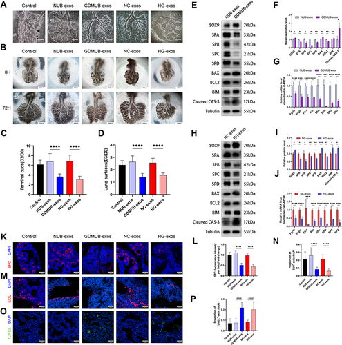 Figure 4 GDM-associated exosomes impeded the growth, branching morphogenesis and maturation of fetal lung explants. (A) PKH67-labeled exosomes could be detected in lung explants after incubated for 72 h. Scale bars, 200 μm. (B–N) The E11.5 lung explants treated with different groups exosomes (200μg/mL) for 72 h. (B) Representative images of E11.5 lung explants following 72 h ex vivo cultures with different groups exosomes. Scale bars, 500 μm. (C and D) Quantification of the number of terminal buds (n=12) and the area of lung explants surfaces (n=12) and expressed as the D3/D0 ratio. (E and F) Western blot analysis of lung surfactant protein A, B, C, and D, SOX9, BAX, BIM, BCL2, and cleaved CAS-3 expression in the lung explants treated with NUB-exos or GDMUB-exos for 72 h, quantified by signal intensity normalized to GAPDH (n=3). (G) Relative gene expression of lung surfactant proteins A, B, C, and D, the fibroblast growth factor 10 (Fgf10) and vascular endothelial growth factor (Vegfa) and its receptors (Flt1 and Kdr) in the lung explants treated with NUB-exos or GDMUB-exos for 72 h were measured by qRT‒PCR (n=9). (H and I) Western blot analysis of lung surfactant protein A, B, C, and D, SOX9, BAX, BIM, BCL2, and cleaved CAS-3 expression in the lung explants treated with NC-exos or HG-exos for 72 h, quantified by signal intensity normalized to GAPDH (n=3). (J) Relative gene expression of lung surfactant proteins A, B, C, and D, the fibroblast growth factor 10 (Fgf10) and vascular endothelial growth factor (Vegfa) and its receptors (Flt1 and Kdr) in the lung explants treated with NUB-exos or GDMUB-exos for 72 h were measured by qRT‒PCR (n=9). (K and L) Immunofluorescence experiments of lung surfactant protein C (SPC) in lung explants (SPC, green; DAPI nuclear stain, blue; scale bar, 50 μm), and quantified by immunofluorescence intensity (n≥10). (M and N) Images of EdU assays showed the proliferating cells of lung explants (EdU, red; DAPI nuclear stain, blue; scale bar 50 μm), quantified by the proportion of EdU+ cells (n≥7). (O and P) Images of TUNEL assay showed the apoptotic cells of lung explants (TUNEL, green; DAPI nuclear stain, blue; scale bar 50 μm), quantified by the proportion of TUNEL+ cells (n=12). *p < 0.05, **p < 0.01, ***p < 0.001, ****p < 0.0001.