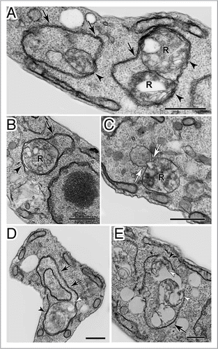 Figure 9 Transmission electron microscopy analysis of Trypanosoma cruzi epimastigotes treated with naphthoimidazole. (A, B, D and E) The parasites showed well-developed endoplasmic reticulum profiles (black arrows) surrounding organelles, especially reservosomes (R), suggesting a close contact between both membranes (black arrowheads), and commonly loss of the integrity of these organelle structures (white arrowheads). (C) A cytoplasmic vesicle near to a reservosome was also observed, suggesting fusion with the organelle (white arrows). Scale bars = 0.5 µm.