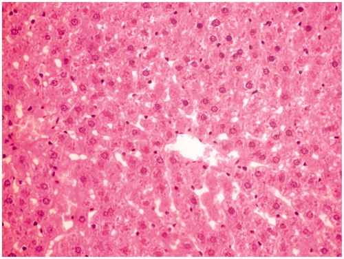 Figure 1. Normal control group rat liver section showing normal cellular architecture with distinct hepatic cells and sinusoidal space.