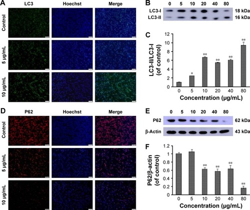 Figure 3 Realgar NPs triggered autophagy in K562 cells.Notes: (A) The cells were treated with specific concentrations of realgar NPs (0, 5, and 10 μg/mL) for 24 h and then fixed and immunostained with antibodies against LC3 (green), and nuclei were counterstained with Hoechst 33342 (blue); original magnification, ×100. (B) K562 cells were treated with specific concentrations of realgar NPs (0, 5, 10, 20, 40, and 80 μg/mL) for 24 h. LC3 protein level was estimated by using Western blot analysis. (C) Quantification of LC3-II/LC3-I shown in (B). (D) The cells were treated with specific concentrations of realgar NPs (0, 5, and 10 μg/mL) for 24 h and then fixed and immunostained with antibodies against P62 (red), and nuclei were counterstained with Hoechst 33342 (blue); original magnification, ×100. (E) K562 cells were treated with specific concentrations of realgar NPs (0, 5, 10, 20, 40, and 80 μg/mL) for 24 h. P62 protein level was estimated by using Western blot analysis. (F) Quantification of P62 shown in (E). n=3; *P<0.05, **P<0.01, realgar NP treatment groups versus 0 μg/mL group.Abbreviation: NP, nanoparticle.