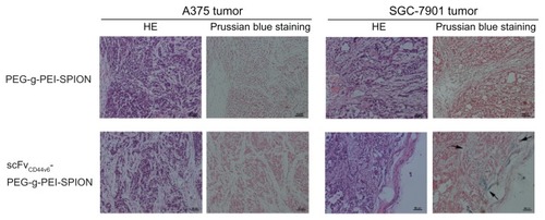 Figure 6 Histology analyses. Hematoxylin and eosin staining and Prussian blue staining were performed on tumor tissues. After Prussian blue staining, blue-positive particles indicated by arrows only appeared in the SGC-7901 tumor area after injection of scFvCD44v6-PEG-g-PEI-SPION, whereas no blue particles were shown at the A375 tumor site in the same mouse. Moreover, in the PEG-g-PEI-SPION group, no SGC-7901 tumor or A375 tumor sites were stained blue following injection.Abbreviations: PEG, polyethylene glycol; PEI, polyethyleneimine; SPION, superparamagnetic iron oxide nanoparticles; scFvCD44v6, cancer-associated CD44v6 single-chain variable fragment; SiRNA, small interfering RNA.