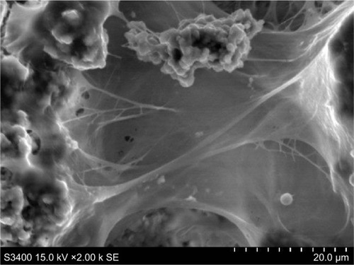 Figure 8 Scanning electron microscopy. Bacteria colonies in fibrin capsules. Secondary electron imaging. Scale bar −200 microns.
