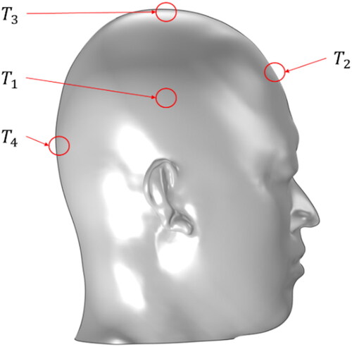 Figure 4. Location of the selected 4 points on the helmeted head to be tested by the thermometer.