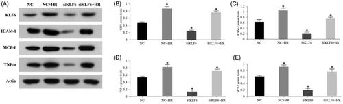 Figure 7. Knockdown of KLF6 expression reduced the HR-induced pro-inflammatory cytokines in HK-2 cells. (A–E) The expression of KLF6, ICAM-1, MCP-1, and TNF-α was measured by Western blot, in NC or siKLF6 cells with or without HR treatments. *p < 0.05 versus NC group; **p < 0.01 versus NC group.