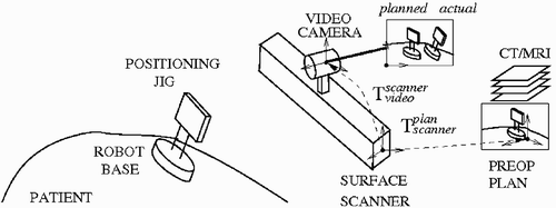 Figure 5. Intraoperative robot positioning computation.