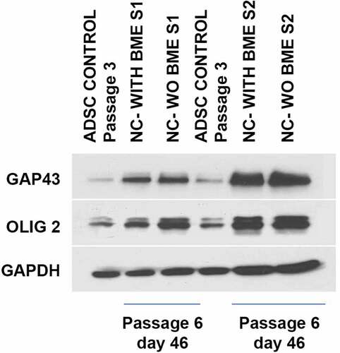 Figure 7. Western blot analysis of ADSC-derived neural-lineage cells for two neural-induced samples from patients S1 and S2 at d 25 after induction with two different treatments: NIM with β-ME (WBME) and without β-ME (W/O BME). Untreated ADSCs used as control.