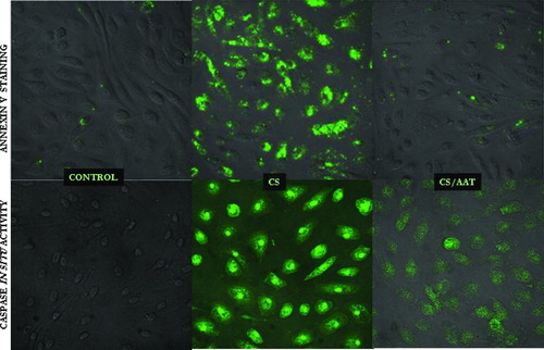 Figure 3 Apoptotic PAEC detected by confocal microscopy. Upper panel represents control cells, CS (18 cigarettes/6 hours) exposed cells, and AAT (20 μ M, 18 hours) pretreated/CS exposed cells stained with Annexin-FITC. The bottom panel represents control cells, CS-exposed cells and CS-exposed cells pretreated with AAT stained with an in situ marker for apoptosis, CaspACE FITC-VAD-FMK. Photomicrographs are representatives of at least 3 experiments. Magnification—400×.