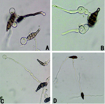 Figure 3. The effect of bacteria-free filtrate on A. alternata spore germination (640×). (A) Germ tube vacuolization; (B) abnormal germination of germ tubes; (C) germ tube vacuolization with high-concentration treatment; (D) control.