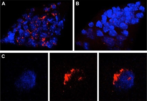 Figure 4 Delivery of siRNA into RAW 264.7 cells by p5RHH-siRNA nanoparticles.Notes: (A) Representative confocal images of RAW 264.7 cells in vitro exposed to fluorescently-labeled siRNA (red) nanoparticles reveal abundant cytoplasmic signal (imaged at 24 hours after initial exposure). (B) Representative confocal images of RAW 264.7 cells exposed to naked siRNA exhibit little cellular uptake. (C) Confocal images of individual cells at high magnification show more diffuse cytoplasmic localization, indicating endosomal release of siRNA. Blue, nuclei; red, siRNA. A and B were captured at magnification of 60× and C was captured at magnification of 60× with digital zoom of 2×.