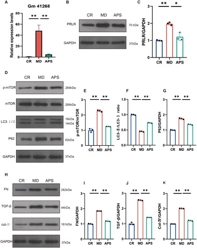 Figure 3. APS regulates Gm41268/prolactin receptor (PRLR) and ameliorates autophagy and renal fibrosis in db/db mice. (A) Validation of Gm41268 expression by qRT-PCR (n = 3). (B, C) PRLR protein levels were detected by western blotting; representative blots and densitometry results are shown (n = 3). (D–G) Protein markers of autophagy were detected by western blotting; representative blots and densitometry results are shown (n = 3). (H–K) Proteins associated with fibrosis were evaluated by western blotting; representative blots and densitometry results are shown (n = 3). Data are presented as the mean ± SD. *p < .05; **p < .001.