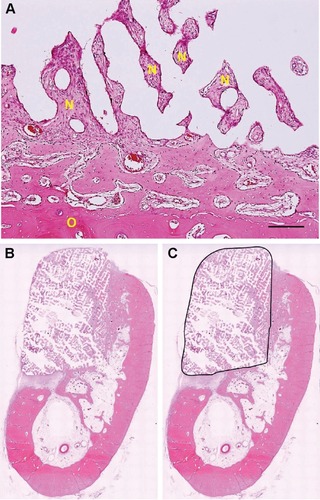 Figure 2 A section stained by hematoxylin and eosin: O=old bone; N=new bone; bar: 200 μm (A). Decalcified sections implanted with two scaffolds. Upon sacrifice at 3 or 8 weeks, each defect was removed with the surrounding tissue, buccolingually sectioned, and stained with hematoxylin and eosin (B). The total scaffold area (black line) was quantified using Image-Pro Plus software; the new bone was traced, and the percentage of new bone fill was determined based on the size of the entire scaffold area (C).