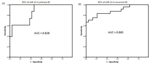 Figure 2 Validation of miR-21 in BC patients and healthy controls. Graphs of receiver operating characteristics (ROC) curve show the area under the curves (AUCs) of miR-21 for discriminating the primary BC patients (A) and the recurrent BC patients (B) from the healthy controls. The interval confidence level was 95%.