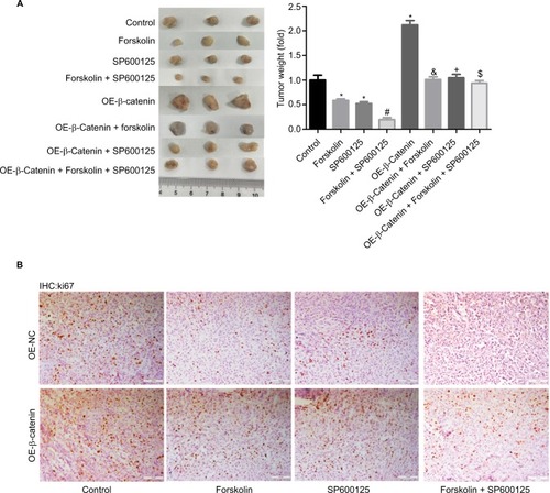 Figure 7 Forskolin/SP600125 reduced tumor growth through downregulating β-catenin in vivo.Notes: (A) Mouse tumor-bearing assay was used to evaluate the tumorigenesis of NK-92 cells with different treatments. (B) Immunohistochemical analysis of the expression of ki-67 in the tumor tissues from different groups in NK-92 cells (scale bar =100 μm) (n=6, *P<0.05, SP600125 group, forskolin group or OE-β-catenin group vs control group; #P<0.05, forskolin + SP600125 group vs forskolin group; δP<0.05, OE-β-catenin + forskolin group vs forskolin group; +P<0.05, OE-β-catenin + SP600125 group vs SP600125 group; $P<0.05, OE-β-catenin + forskolin + SP600125 group vs forskolin + SP600125 group).Abbreviation: IHC, immunohistochemistry.