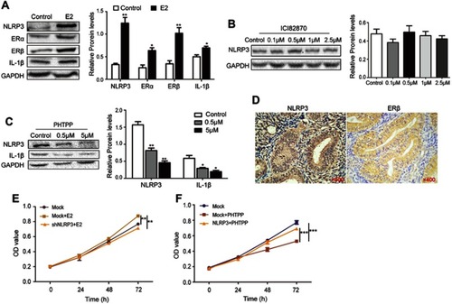 Figure 4 Estrogen enhanced NLPR3 inflammasome activation and endometrial cancer cell proliferation in vitro. (A–C) Ishikawa cells were treated with estrogen, ICI182870 or PHTPP for 24 hrs and relative levels of NLPR3, ERα, ERβ, IL-1β were determined by Western blot. (D) The expression of NLPR3 and ERβ in human endometrial cancer tissues was examined by immunohistochemistry (magnification ×400). (E) Estrogen promoted the proliferation of Ishikawa cells and NLRP3 silencing dramatically reversed the effects. (F) Blockage of ERβ inhibited the proliferation of Ishikawa cells and NLRP3 overexpression dramatically reversed the effects. Data are representative images or expressed as mean ± SEM of each group. *P<0.05, **P<0.01, ***P<0.001.