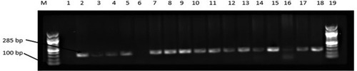 Figure 2 Agarose gel (1%) electrophoresis showing the amplification of invA gene in representative presumptive Salmonella isolates in chickens obtained from Mafikeng, North-west province, South Africa.Notes: Lane 1 = no template (negative control), Lane 2 = Salmonella Typhimurium ATCC 14028TM (positive control); Lane 6 = Escherichia coli ATCC 259622TM (negative control), lane 2 to 18 = positive amplification of invA gene at 286 bp, lane 6 = no amplification.Abbreviations: M, DNA marker (100 bp); bp, base pairs.