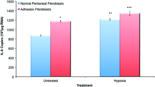 Figure 1.  IL-6 expression in normal peritoneal and adhesion fibroblasts. Adhesion fibroblasts had increased IL-6 expression as compared to normal peritoneal fibroblasts. Exposure to hypoxia increased IL-6 expression in both normal and adhesion fibroblasts. (*, ** p < 0.05 as compared to normal peritoneal fibroblasts, *** p < 0.05 as compared to untreated adhesion fibroblasts and compared to hypoxia treated normal peritoneal fibroblasts).