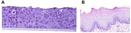 Figure 2 Morphological structure of human 3D reconstructed oesophageal epithelium (A) and its similarity with the biopsy of human full-thickness oesophageal mucosa (B).