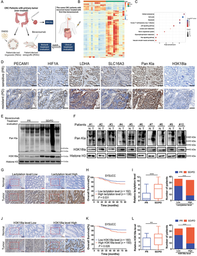 Figure 1. Colorectal cancer (CRC) resistance to bevacizumab treatment exhibited increased lactylation levels which was associated with poor survival in CRC patients.