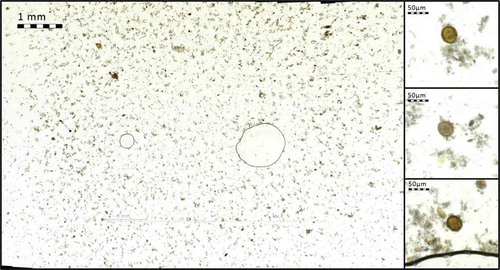 Figure 2. Region of glass slide captured with the mobile microscope. Enlarged areas (right) showing A. lumbricoides eggs in sample (magnified images showing native, full resolution of captured images at 100% digital magnification).