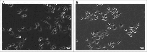 Figure 1. Morphological comparison of PC 3 (A) and DU 145 (B) cell lines. Both cells lines showed epithelial morphology and adherence to plastic culture plates; DU 145 cells were smaller, rounded cells, while PC 3 cells were larger, with more cytoplasmic extensions. Scale bar, 100 μm.
