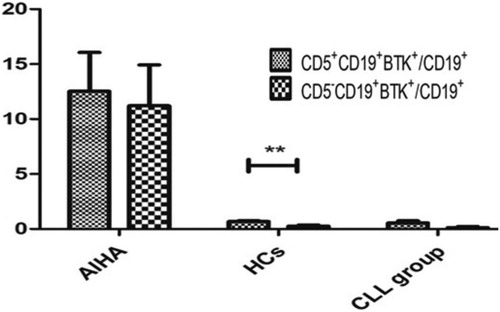 Figure 3. BTK expressions in CD5+ and CD5- lymphocytes from three groups. There is no different in AIHA CLL. **P < 0.01 *P < 0.05.