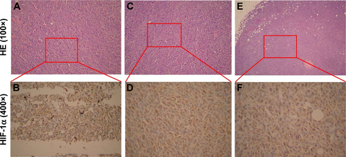 Figure S5 (A, C, and E) Representative images of HE staining of tumor tissues in various mice before injection (100×). (B, D, and F) Representative images of immunohistochemical staining of HIF-1α protein in tumor tissue in various mice before treatment (400×).Abbreviations: HE, hematoxylin and eosin; HIF-1α, hypoxia inducible factor-1α.