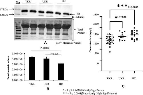Figure 3 Validation of haptoglobin (Hp) expression in plasma. (A) Representative Western blot image of pooled plasma samples (TKR = 12, UKR = 12, HCs = 12) developed using anti-Hp antibody to detect Hpα. Hpα protein expression was normalized with total protein (lower panel) with Ponceau staining of membrane. (B) Densitometric analysis showing 1.5 fold upregulated Hpα in TKR (pP=0.0021) and 1.4-fold in UKR (pP=0.005) compared to HCs. Analysis was done using mean values of three independent experiments. (C) ELISA results showing Hp concentrations in blood plasma of TKR (n=40), UKR (n=11) and HCs (n=17). Average Hp concentration was found lowered by 1,417 ng/μL in TKR and 1,584 ng/μL compared to 1,655 ng/μL in HC plasma samples. The average fold change was found to be 0.8 (P=0.0003) and 0.95 (P=0.05) in TKR and UKR compared to HCs, respectively. TKR also showed 0.89-fold (P=0.05) lower levels of Hp than UKR.