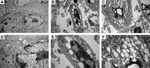 Figure 7 Electron microscopic examination of cellular localization of ALA PLGA NPs.Notes: NPs are indicated by arrowheads. Control group: (A) 7,400× and (D) 17,500×. ALA NP group: (B) 7,400× and (E) 17,500×. Microneedling combination group: (C) 7,400× and (F) 17,500×.Abbreviations: ALA, 5-aminolevulinic acid; PLGA, polylactic-co-glycolic acid; NPs, nanoparticles.