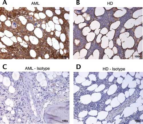 Figure 5. STC1 expression is increased in the BM from AML patients compared to HD. Representative immunohistology staining of STC1 (brown) on AML patient (A; AML sample 22) and HD (B) derived BM sections as compared to isotype control (C, D). 100× magnification.