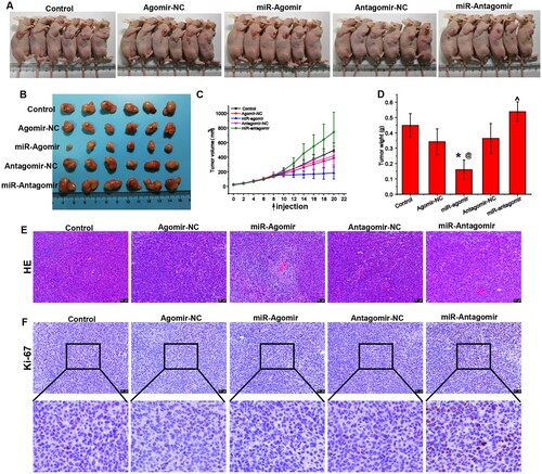 Figure 4. miR-149-3p suppresses U-937-induced tumor growth. (A) Representative photos of tumor-bearing mice injected with U-937 cells and treated with miR-antagomirs/antagomirs. (B) Representative photos of tumors extracted from the mice. (C) Growth curve of tumor xenografts in mice. (D) Tumor weight on day 11 after treatment with miR-antagomirs/antagomirs. (E) HE staining of tumor tissue. (F) Immunohistochemical staining of Ki-67 protein expression in tumor tissue. Data represents the mean ± standard deviation. * p < 0.05 vs. control; @ p < 0.05 vs. Agomir-NC; ^ p < 0.05 vs. Antagomir-NC.