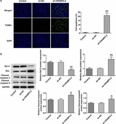 Figure 3. CRABP2 knockdown aggravates apoptosis of RB cells. (a) The apoptosis of WERI-RB1 transfected with sh-CRABP2-2 was analyzed by Tunel assay. (b) The expression of apoptosis related proteins (Bcl-2, Bax, cleaved-caspase 3 and cleaved-caspase 9) in WERI-RB1 transfected with sh-CRABP2-2 was determined by Western blot. **P < 0.01 and ***P < 0.001 vs. control group. ##P < 0.01 and ###P < 0.001 vs. sh-NC group.