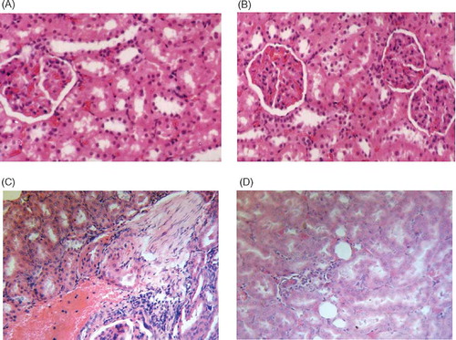 Figure 3. Effect of GTE on the histopathological changes of renal tissue in uninephrectomized rats injected with GM. (A) Renal tissue of control rats showing normal renal parenchyma [hematoxylin and eosin (H&E) × 1200]. (B) Renal tissue of rats received 300 mg/kg/day GTE for 30 days showing normal renal tissue (H&E × 600). (C) Renal tissue of rats received 50 mg/kg GM twice daily for 15 days showing extensive hemorrhage, focal fibrosis, necrotic changes of renal tissue, and cell infiltration (H&E × 800). (D) Renal tissue of rats received 50 mg/kg GM twice daily for 15 days and 300 mg/kg/day GTE for 30 days showing mild infiltration of round cells among tubules (H&E × 800).