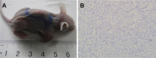 Figure S1 (A) Adult female BALB/c nude mice carrying subcutaneous xenograft tumors of A549 cells at right hind limb; (B) H&E staining of xenograft tumor slice (200×).