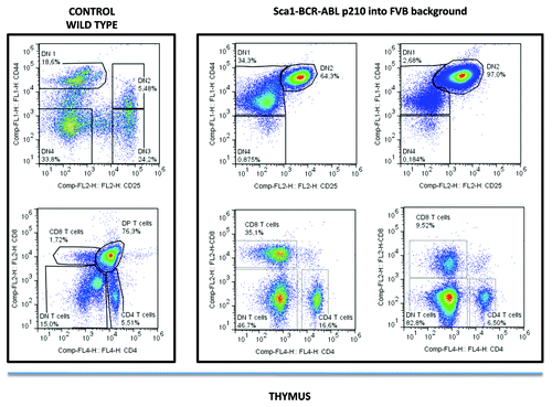 Figure 3. Phenotypes of lymphomas in Sca1-BCR-ABLp210 into FVB background. All lymphomas analyzed had a similar phenotype with predominantly CD4−CD8− double-negative thymocytes. The use of CD25 and CD44 lineage markers allowed to identify these CD4−CD8− double negative thymocytes as DN2 (CD44+CD25+) thymocytes.