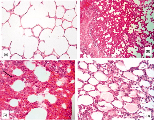 Figure 3. Light microscopy photomicrographs of representative histological sections of the lung of: (A) Control group showing normal appearance (H&E × 200); (B) CP group showing foci of edema and congestion, marked thickening of the alveolar septa and the alveolar lining is prominent (H&E × 200); (C) Higher power showing increased cellularity of the alveolar septa by inflammatory cells (arrow) and extravasated blood (H&E × 400) and (D) CP/Allicin group showing thickening of the alveolar septa in 35% of all examined fields (H&E × 400).