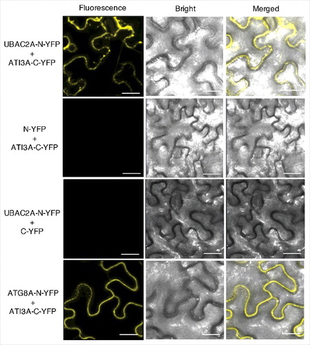 Figure 8. BiFC analysis of ATI3-UBAC2 interactions. BiFC fluorescence was observed in the transformed N. benthamiana leaf epidermal cells from complementation of the N-terminal half of the YFP fused with UBAC2A (UBAC2A-N-YFP) by the C-terminal half of the YFP fused with ATI3A (ATI3A-C-YFP). No fluorescence was observed when UBAC2A-N-YFP was co-expressed with unfused C-YFP or when unfused N-YFP was co-expressed with ATI3A-C-YFP. YFP epifluorescence, bright-field and emerged images of the same cells are shown. BiFC fluorescence from complemented ATG8A-N-YFP and ATI3A-C-YFP is also shown for comparison of punctate fluorescent structures. Bar: 20 μm.