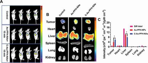 Figure 6. (a) Ultrasound image. (b) The average intensity values of Au-PFH-NAs and C-Au-PFH-NAs. P values < 0.05 were considered statistically significant (*p < 0.05)