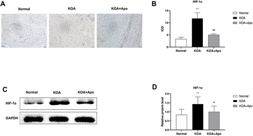 Figure 3 Acupotomy reduced the expression of HIF-1α in rabbit synovial tissue. (A) Representative HIF-1α IHC sections of synovial tissues in each group, 200×. (B) Relative IOD value in each group. Semiquantification of IHC sections was evaluated by calculating the positive areas of HIF-1α. Data were analyzed by Image J Pro Plus 6.0. **P <0.01 vs the Normal group. ##P < 0.01 vs the KOA group. (C) Typical protein bands of HIF-1α. (D) Protein level comparison of HIF-1α between groups. **P < 0.01 vs the Normal group. #P < 0.05 vs the KOA group. Data were analyzed by Image J.