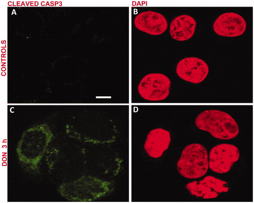 Figure 2. Exposure of Jurkat cells to DON induces apoptosis. Cells were treated for 3 h with 0.5 μM DON and cleavage of caspase-3 was then measured. (A, B) untreated; (C, D) treated. (A, C) cleaved caspase-3 staining; (B, D) DNA staining with DAPI. Scale bar: 10 μm.