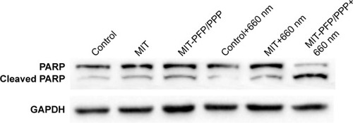 Figure 6 Western blot analysis of PARP expression in MCF-7/ADR cells treated with MIT and MIT-PFP/PPP mixed micelles with or without laser irradiation at the power of 24 mW for 0.5 h with a 660 nm fiber-coupled laser system.Note: The experiments were carried out in triplicate.Abbreviations: MIT, mitoxantrone; PARP, poly ADP-ribose polymerase; PFP, poly(ε-caprolactone)-pluronic F68-poly(ε-caprolactone); PPP, poly(d,l-lactide-co-glycolide)–poly(ethylene glycol)–poly(d,l-lactide-co-glycolide).