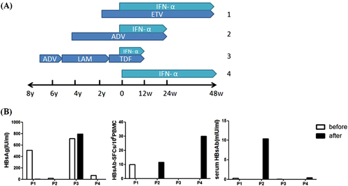 Fig. 6 HBs-Specific memory B cell response with PEG-IFN treatment.a Therapeutic regimens of four CHB patients. Patient 1, 2, and 3 had combination of PEG-IFN with nucleoside analogs while patient 4 had PEG-IFN treatment alone. b Serum HBsAg levels, HBs-specific B cells and serum HBsAb titers before (white column) and after (black column) PEG-IFN treatment of these 4 patients were displayed. ETV entecavir, ADV adefovir dipivoxil, LAM lamivudine, TDF tenofovir