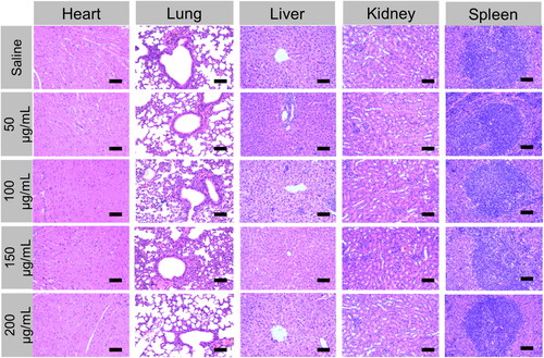 Figure 12. H&E staining images of major organs (heart, liver, spleen, lung, and kidney) were collected from different treatment groups on day 9 post-treatment.