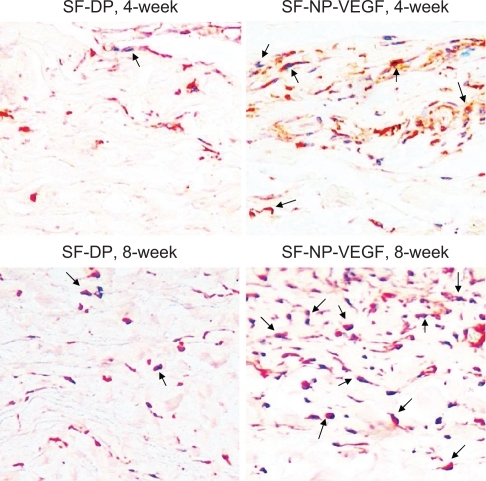 Figure 7 Immunohistochemical staining of fibroblasts. The fibroblasts were stained by anti-vimentin antibody, original magnification × 200. The red stained cells are the fibroblasts.Note: The arrows indicate positive staining.Abbreviations: DP, decellularized scaffolds; NP, nanoparticle; SF, scaffolds; VEGF, vascular endothelial growth factor