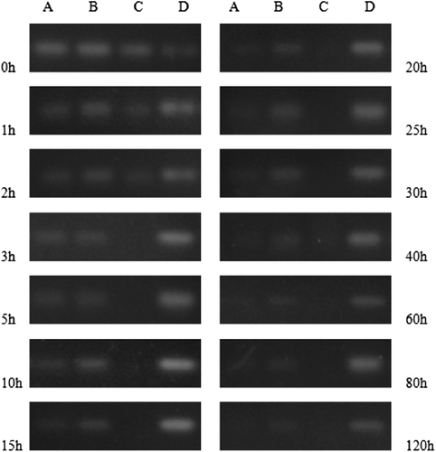 Figure 9. Degradation of SiRNA-MEND by serum. (A) DOTAP/SiRNA; (B) SiRNA-MEND; (C) Naked SiRNA; (D) Marker.