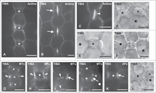 Figure 7. Protodermal areas of seedlings incubated with TIBA. (A–C) Optical sections of stomatal rows after aniline blue staining. The asterisks mark advanced GMCs, the arrows young stomatal complexes and the arrowhead in (C) a newly formed daughter cell wall of the symmetrical GMC division. Note the absence of subsidiary cells. (D) Treated SMC (square) as seen in DIC optics. The nucleus (N) is far from the inducing GMC (asterisk). (E and F). DIC optical views of a persistent GMC (E) and a young stomatal complex lacking subsidiary cells (F). The SMCs in (F) (squares) are not polarized. (G and H) Young (G) and advanced (H) treated GMCs (asterisks) after tubulin immunolabeling. The arrowheads show optical sections of the interphase MT-ring. (I and J) Treated SMC (square) following tubulin immunolabeling in external (I) and median (J) optical plane. The arrows point to sections of the preprophase MT-band of the SMC and the arrowheads to sections of the interphase MT-ring of the GMCs. N: nucleus. (K and L) Treated advanced GMC (asterisk) and one of the neighbor SMCs (square) after AFs staining (K) and in DIC optics (L). The arrows show the AF-patch of the SMC. In (L) the SMC bulges toward the "inducing" GMC and its nucleus (N) has not occupied its polar position (compare Fig. 2C). Treatments: TIBA (A–C) 100 μM, 48 h; (D–L) 300 μM, 48 h. Scale bars: 10 μm.