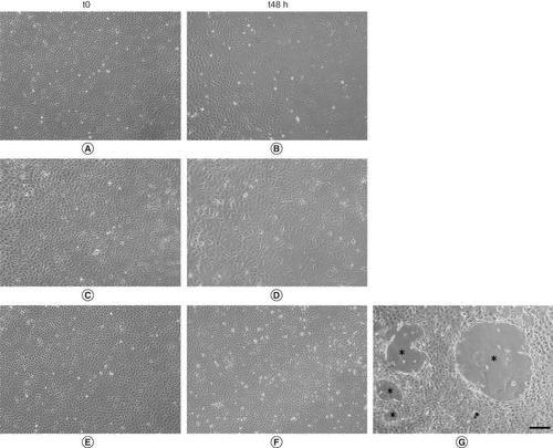 Figure 2. Effect of human adipose-derived stem cell-conditioned medium treatment on lymphatic endothelial cell culture. (A, C & E) Representative images of cells after 24h of serum starvation (t0). (B) Cells maintained in Dulbecco’s modified Eagle medium (DMEM)0.1% for 48h of culture (t48). (D) Cells maintained for 48h of culture in DMEM10%. (F & G) Cells maintained for 48h of culture in human adipose-derived stem cell-conditioned medium. (G) Lymphatic endothelial cells maintained in human adipose-derived stem cell-conditioned medium were able to organize vessel-like structure (*). Scalebar 200 µm.